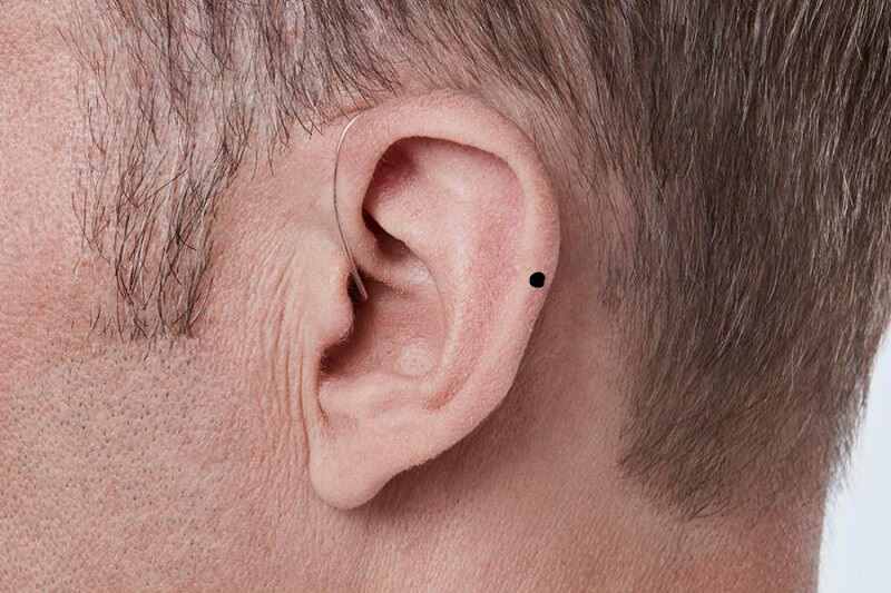 Nam giới có nốt ruồi ở vành tai